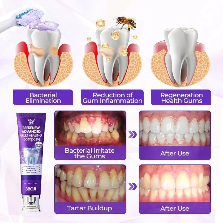 BBOJI® BeeRenew Advanced Gum Healing Toothpaste