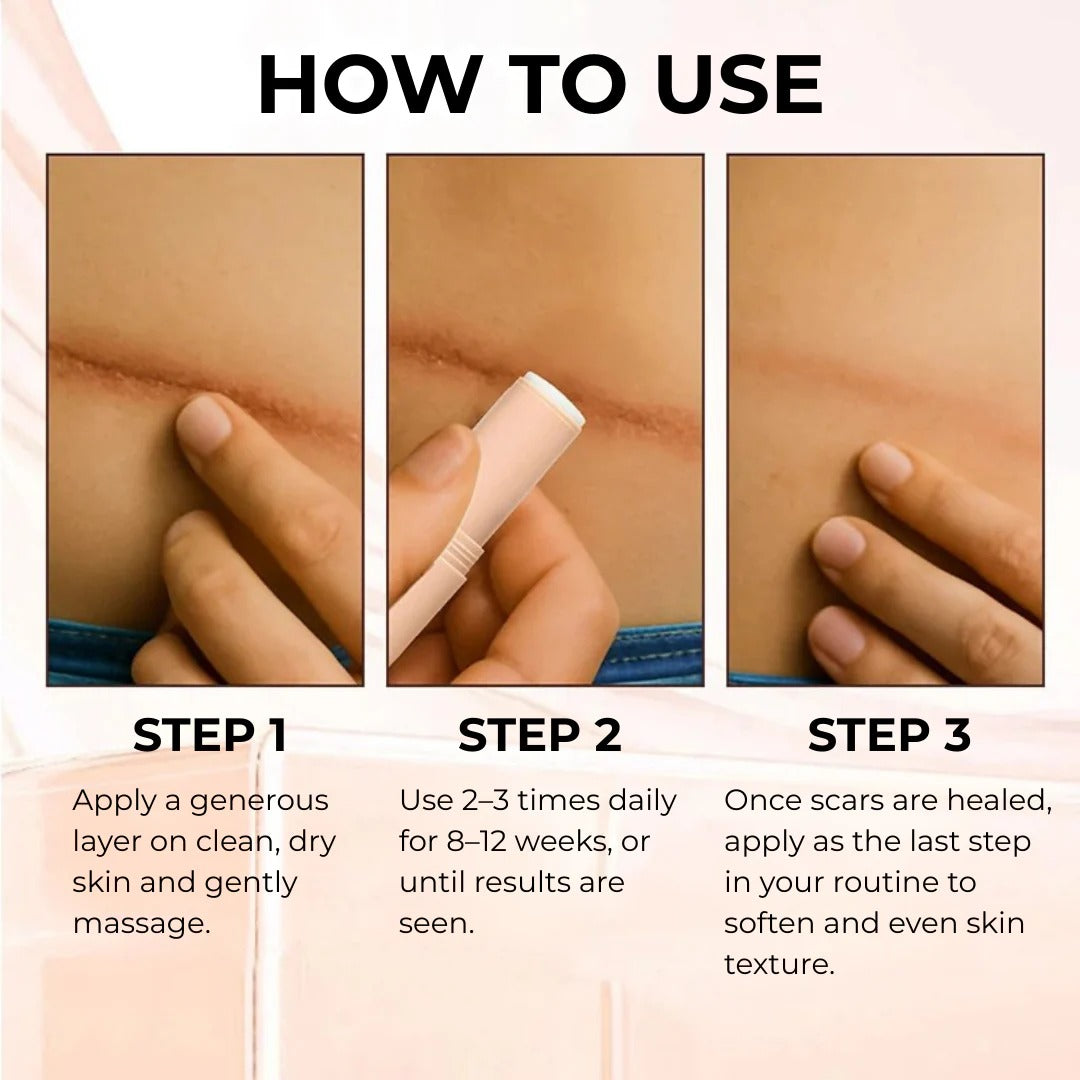 Alisanda Silicone Scar Stick - For Face and Body