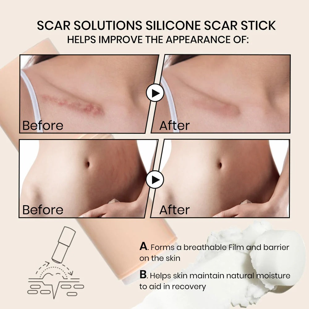 Alisanda Silicone Scar Stick - For Face and Body
