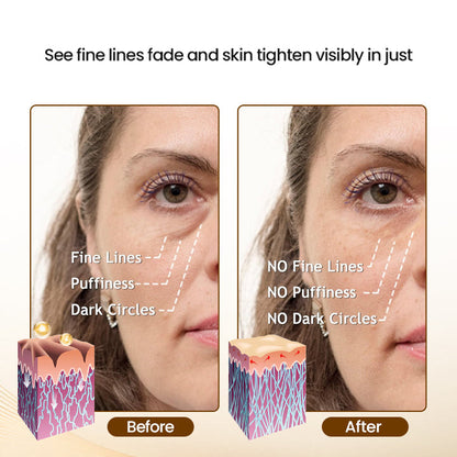 LOVILDS™Skin Firming and Wrinkle Reducing Essence