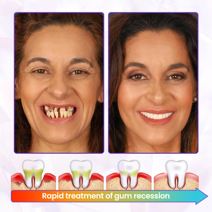 BBOJI® BeeRenew Advanced Gum Healing Toothpaste