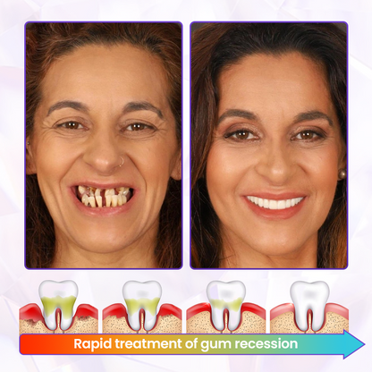 BBOJI® BeeRenew Advanced Gum Healing Toothpaste